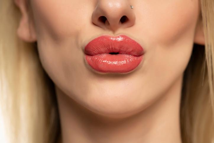 Lip Augmentation Without Complications: 10 Rules