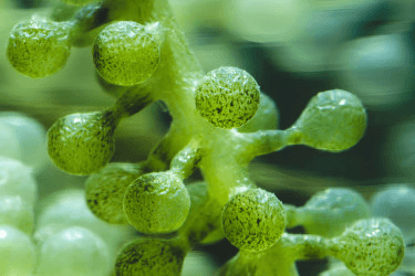 Потеря баланса: что влияет на микрофлору влагалища