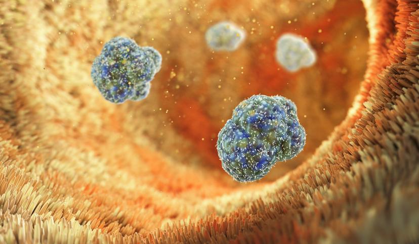 4 главных вопроса про холецистит